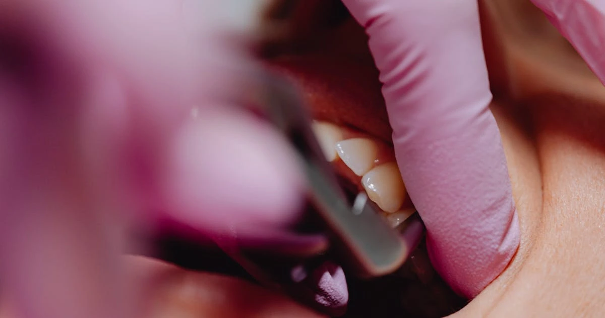 Exame periodontal detalhado mostrando instrumentos odontológicos